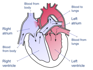 Atrial_septal_defect-en