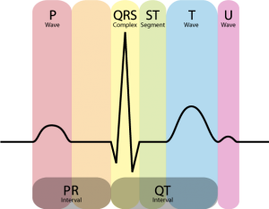 ECG_Complex